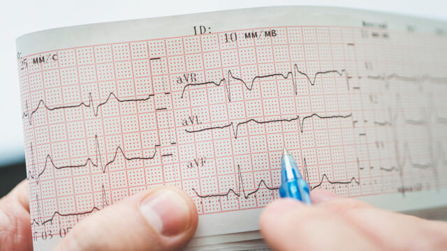 Jak często należy wykonywać badanie EKG?